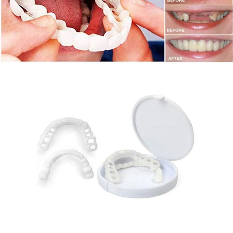 Carillas Snapon Smile